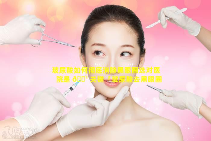 玻尿酸如何彻底消除黑眼圈选对医院是 🌹 关键「玻尿酸去黑眼圈效果能保持多长时间 🐎 」